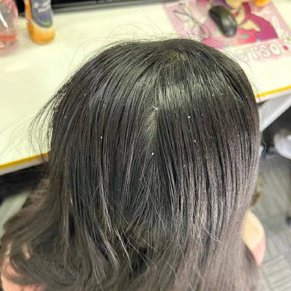 止痒洗发水哪款好