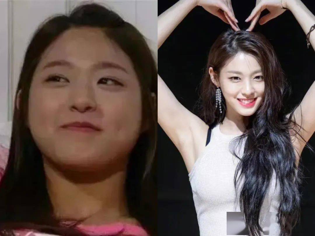 为了瘦1斤她居然去抽血