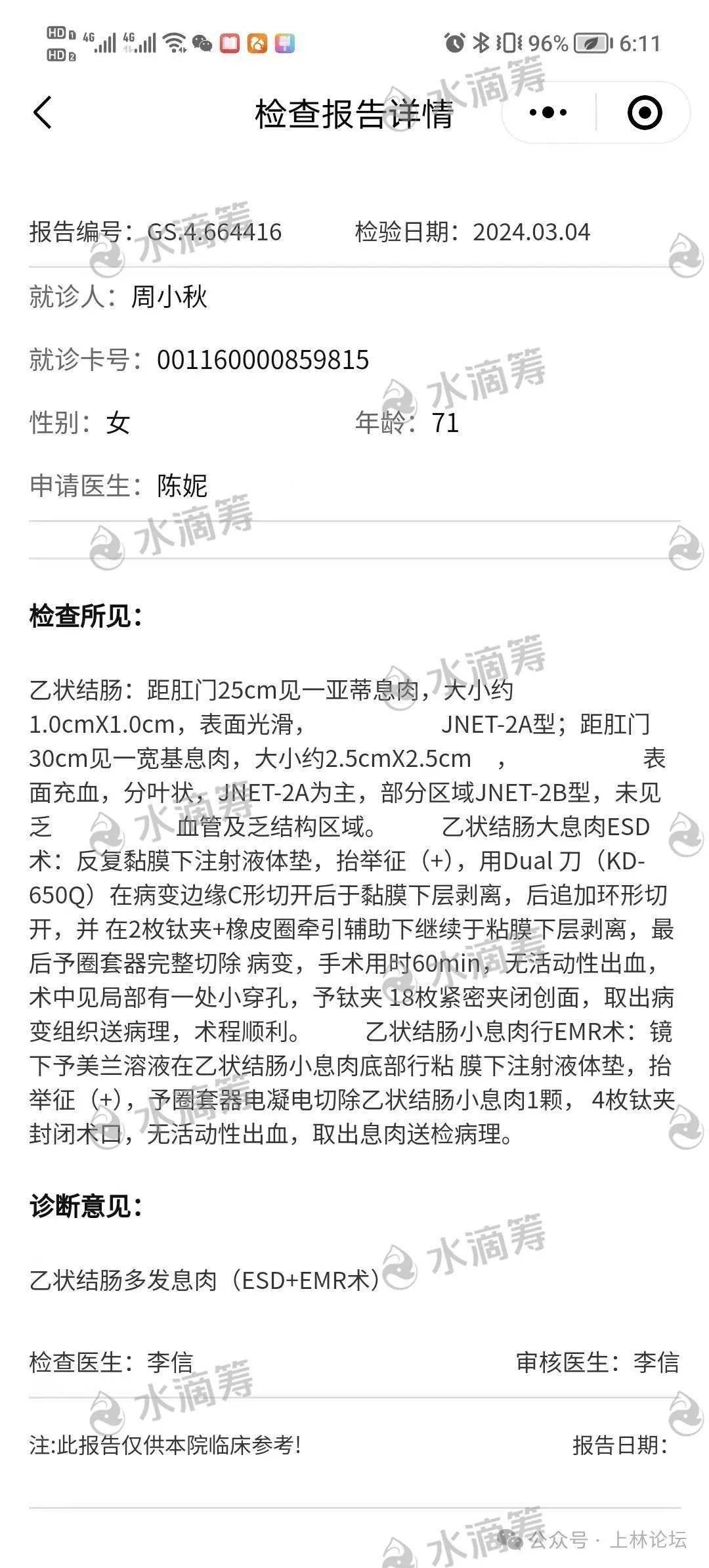 以前身体一直很好,刚开始发病是在2023年4月份检查出来是高血压,胃炎
