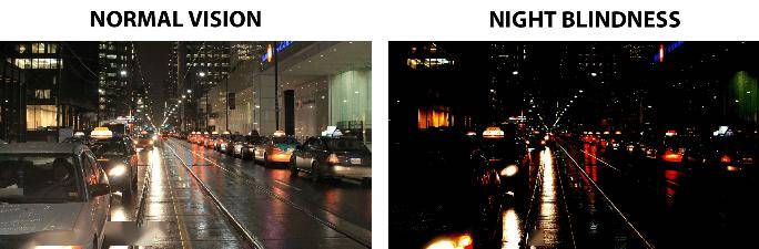 什么是"夜盲症"?