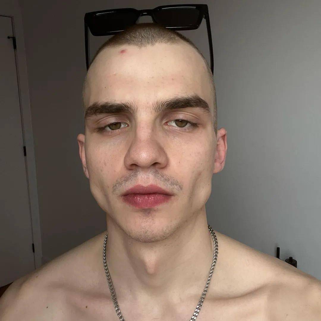 天啊昔日鲜肉男模m秃了