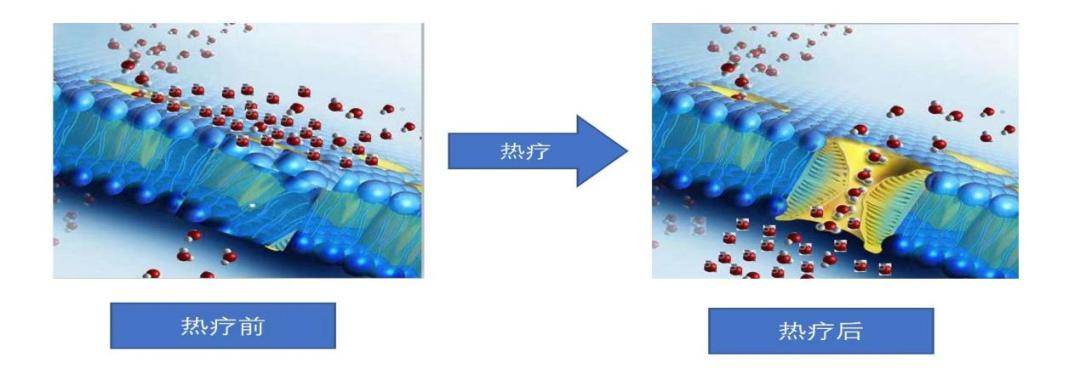 肿瘤热疗,你了解多少?