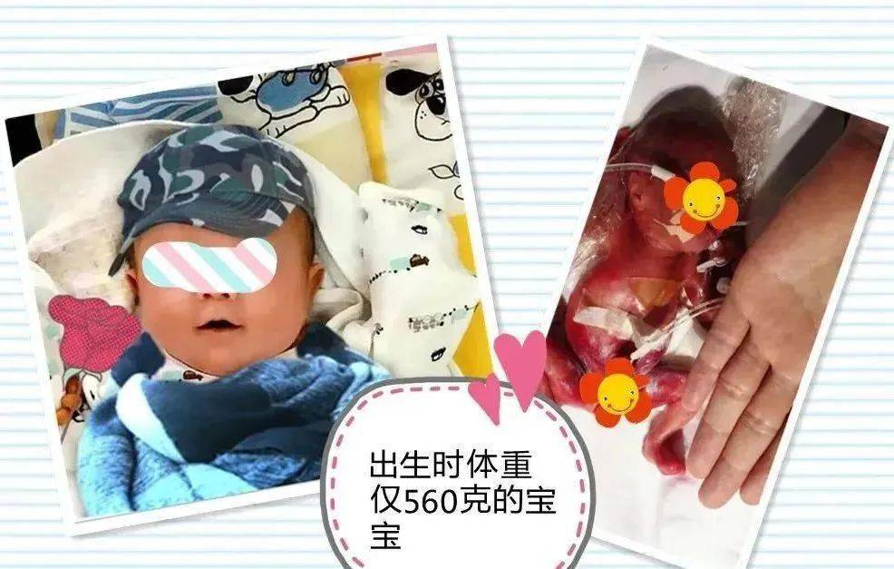 胎龄21周出生仅9两奇迹宝宝在深圳出院了