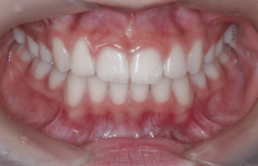 口臭洁牙老年口腔中医口腔门诊即将开诊雁江区人民医院