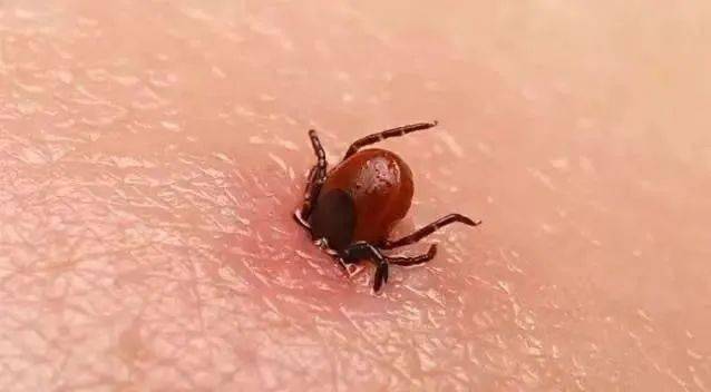 警惕严重可致命即将进入高发季