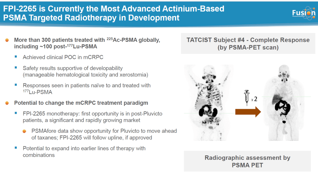 Unlocking the Future of Prostate Cancer Detection with PSMA PET CT Scan