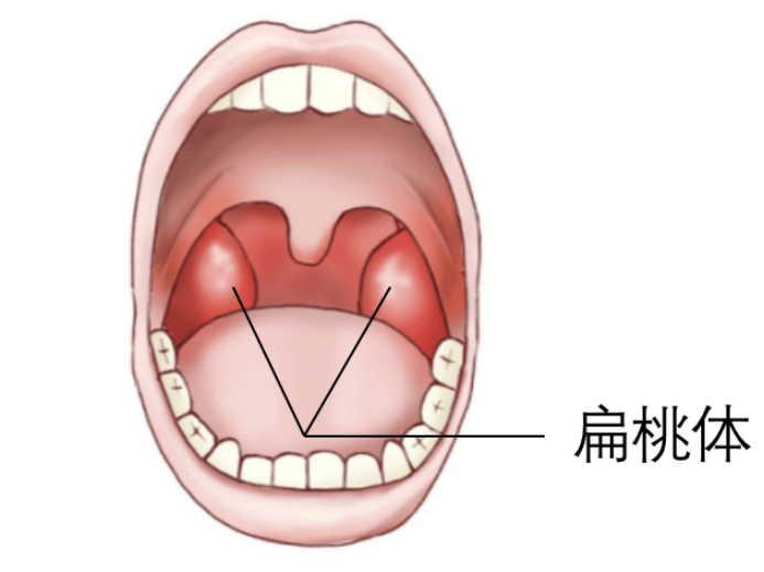 腭腺在什么位置图片图片