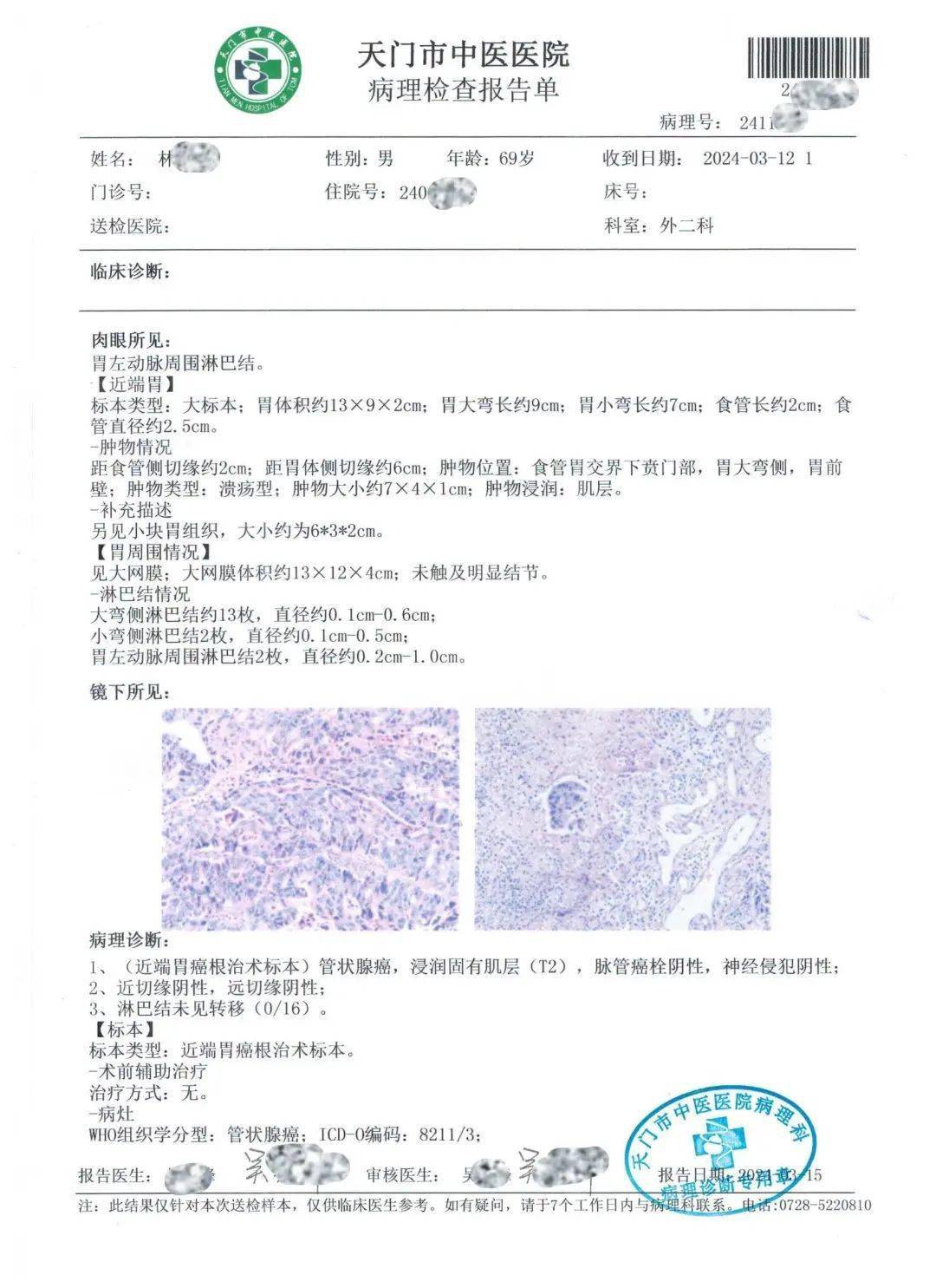 病理报告单 肿瘤图片