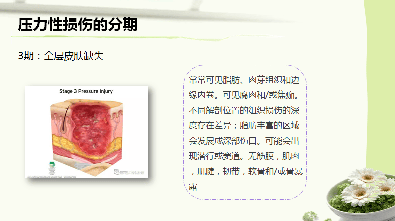 141购买知护优品压力性损伤临床防治国际指南2019 (第3版) 王泠