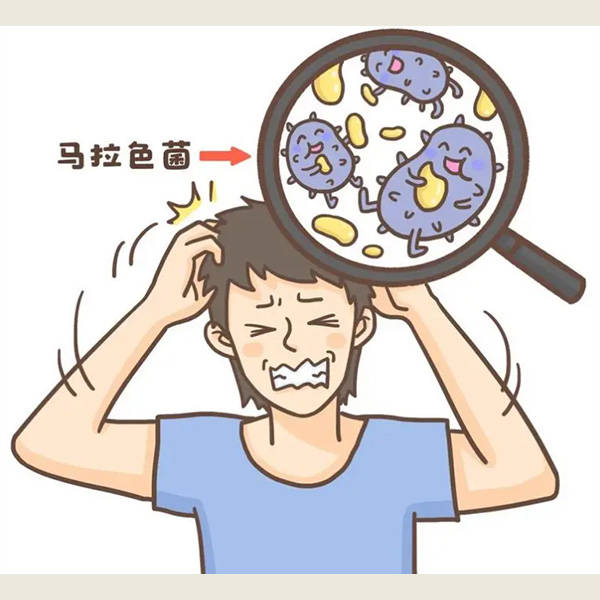 头发痒掉头皮屑用什么洗发水去屑止痒的洗发水排行榜