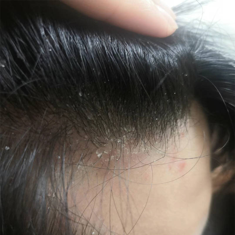 女性控油去屑止痒洗发水_头皮屑_问题_头发