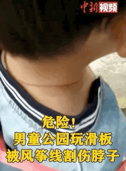 摩托头盔的系绳被风筝线割断脖子也受了伤小小风筝虽然好玩但是如何