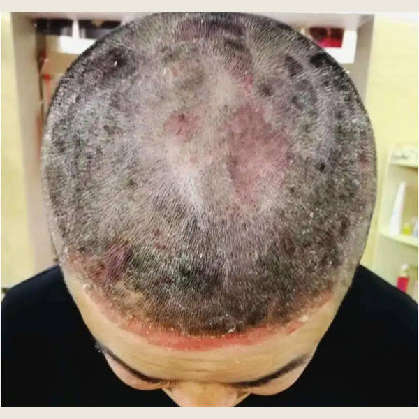 10岁儿童用什么去屑洗发水去屑滋养洗发水排行