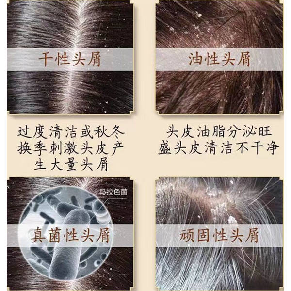 国产洗发水哪个好用柔顺去屑好点的洗发水推荐