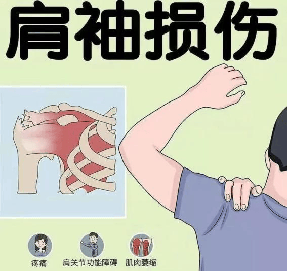 肩袖损伤还是肩周炎?分不清这个后果很严重哦