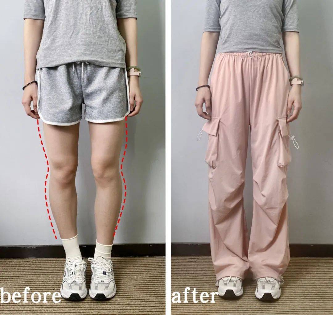 直筒宽松的裤型包容度高,小腿外翻 o型腿亲测穿上腿部缺陷被遮掩所以