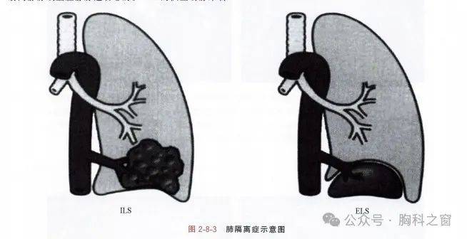 这个肺炎不一般