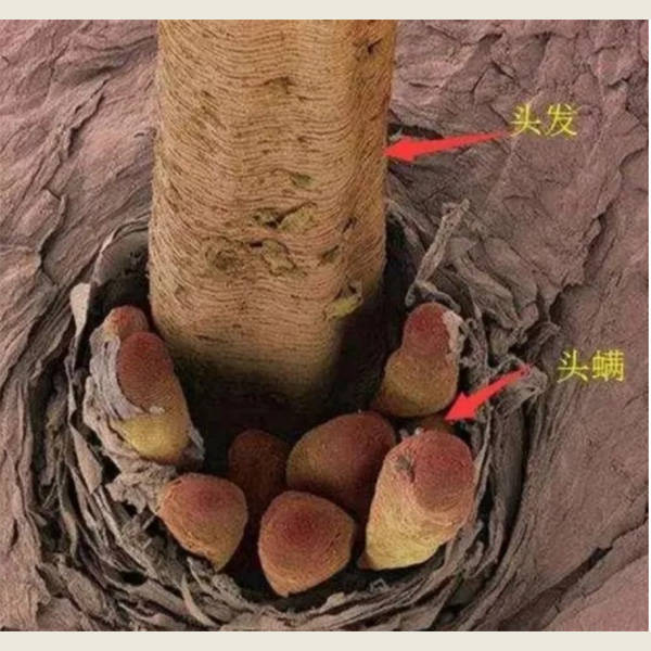 小红疹可以是皮肤过敏,湿疹,接触性皮炎或药物反应等的症状.