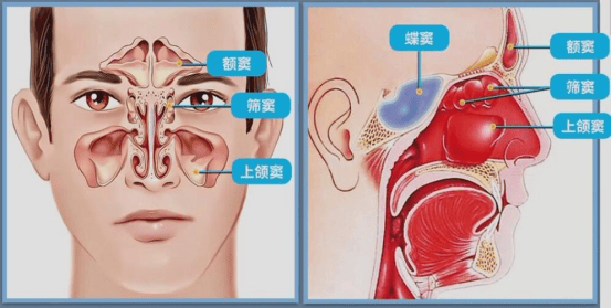 【围观】咳到出血,原来是鼻子出问题了