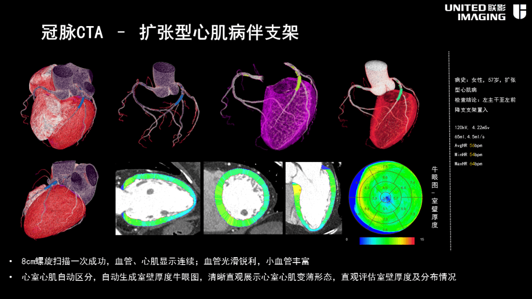 造福剑川百姓剑川县人民医院引进联影160排ct