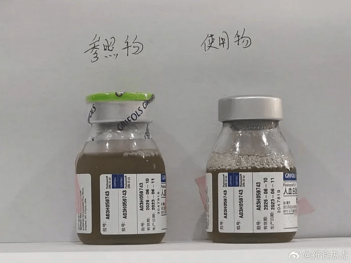 暂且不论这瓶白蛋白是否有问题,但是在门诊静脉注射白蛋白,可以说都是