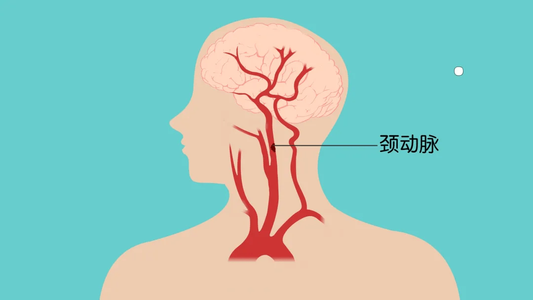 颈动脉在哪边图片