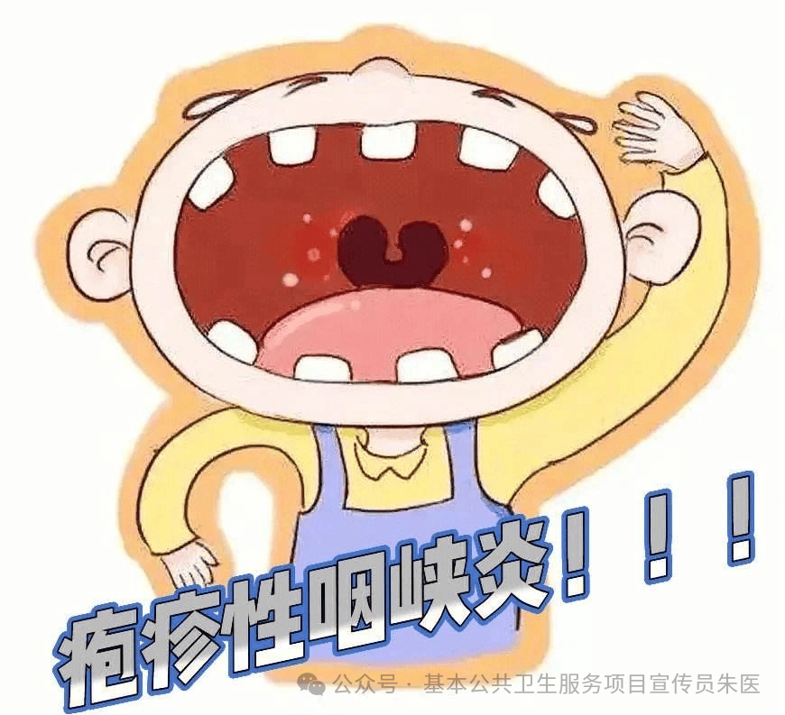 咽峡炎_治疗_患儿