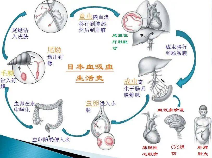 血吸虫尾蚴性皮炎图片