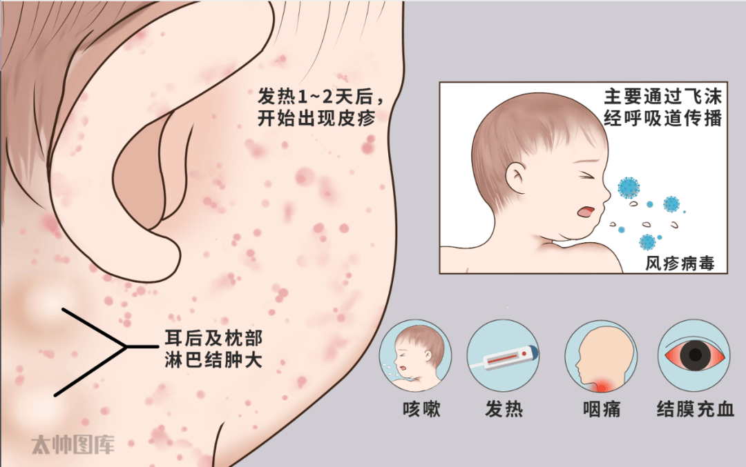 麻风病传染途径是什么图片