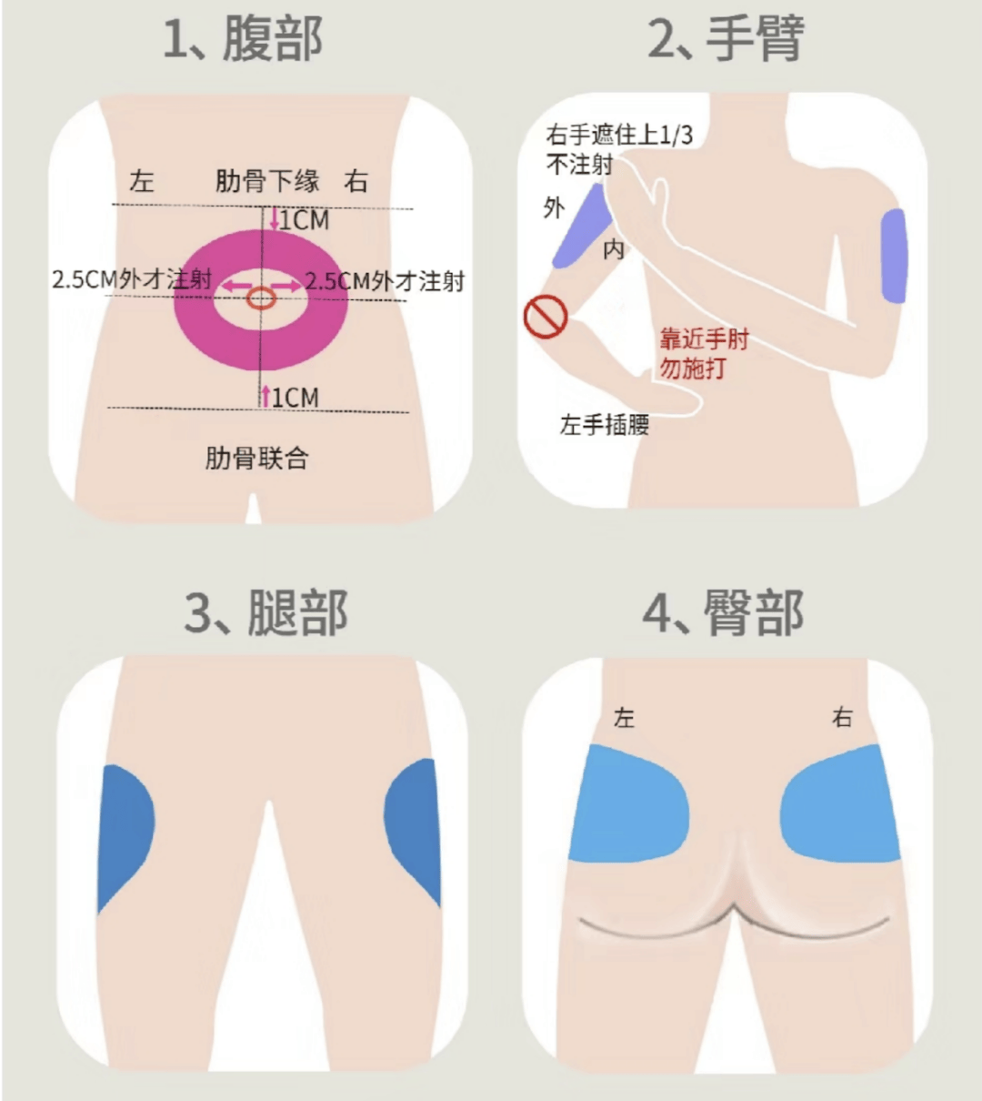 人体适合注射胰岛素的部位包括腹部