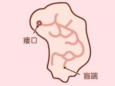 耳瘘图片大全图片