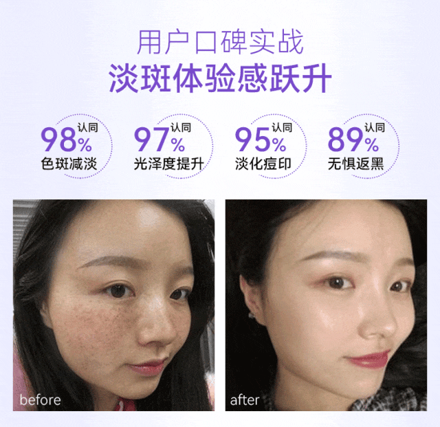 偷偷告诉你,「色斑」最怕的一种东西,再严重的斑都有救!