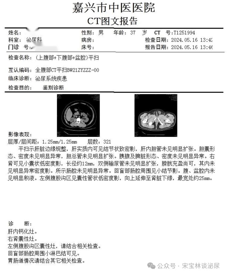 睾丸癌的检查结果图片图片