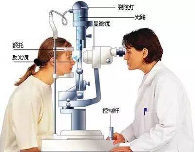 从原理流程到具体检查项目一文掌握裂隙灯的使用图文并茂