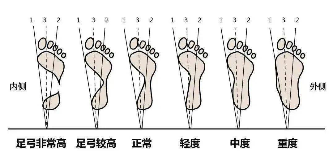29全国爱足日丨关注健康,从足做起_足部_治疗_手术