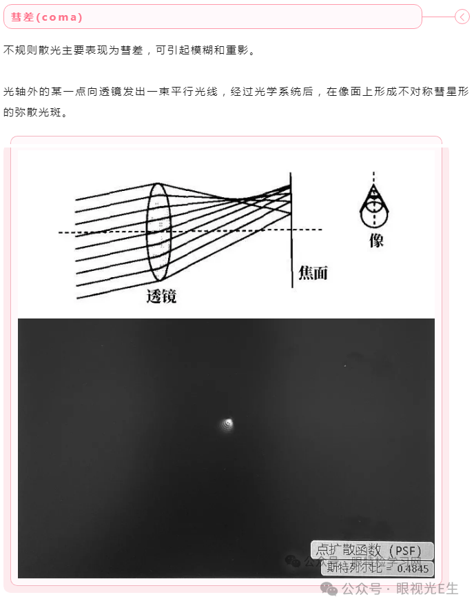 不规则散光地形图图片