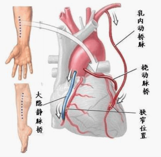 肋间血管走行图片