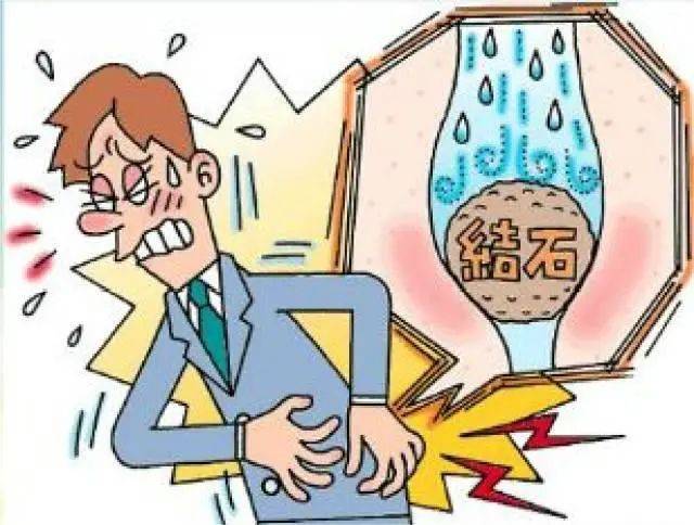 夏季泌尿系结石高发 微创新术式助力"水落石出"