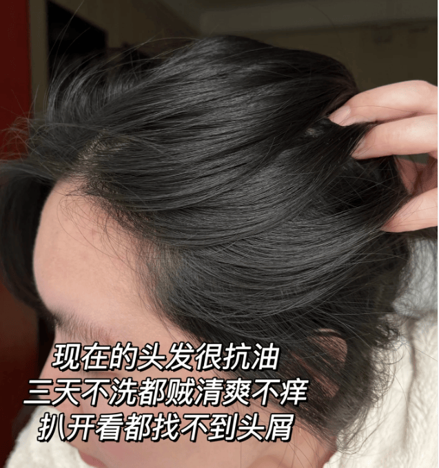 世界十大名牌洗发水_头皮_去屑_问题