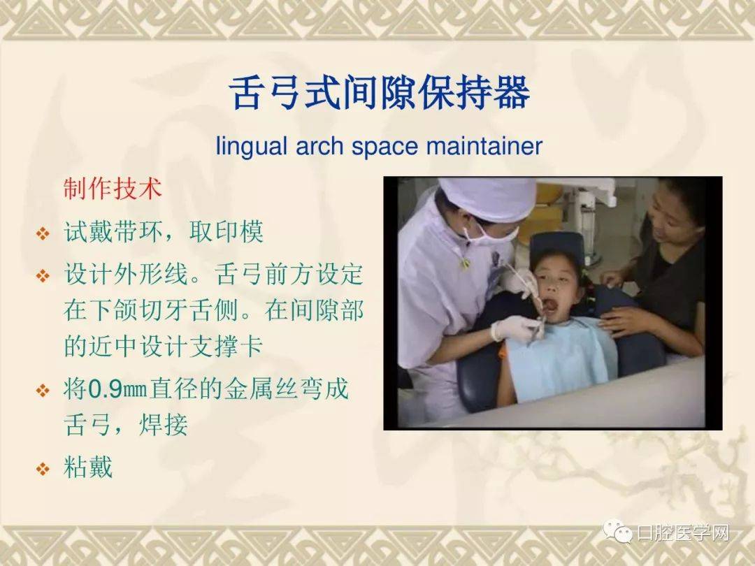 间隙保持器的种类,适应证及制作