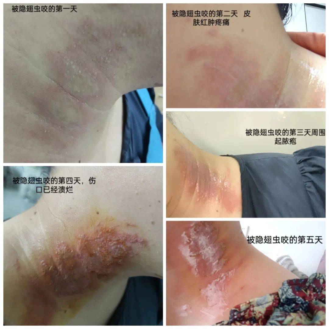"毁容"杀手来临,千万不能拍