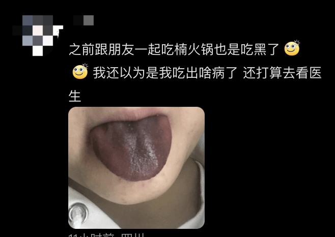 青岛也有多家连锁_铁锅_网友_舌头