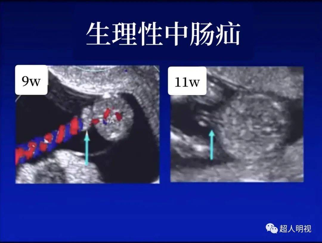 肠袢是什么图片图片