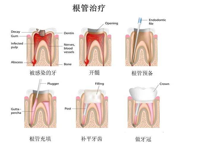牙齿上出现了黑线,别慌,这样做就可以了.