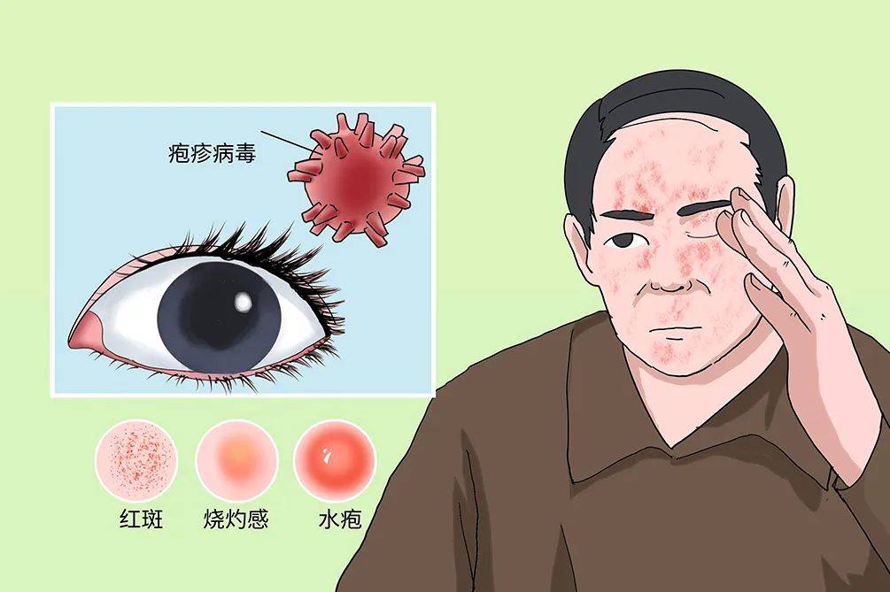 嘴唇细菌感染症状图片图片