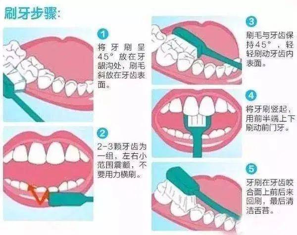 医点通丨从"齿"开始 关注口腔健康_牙齿_疾病_细菌
