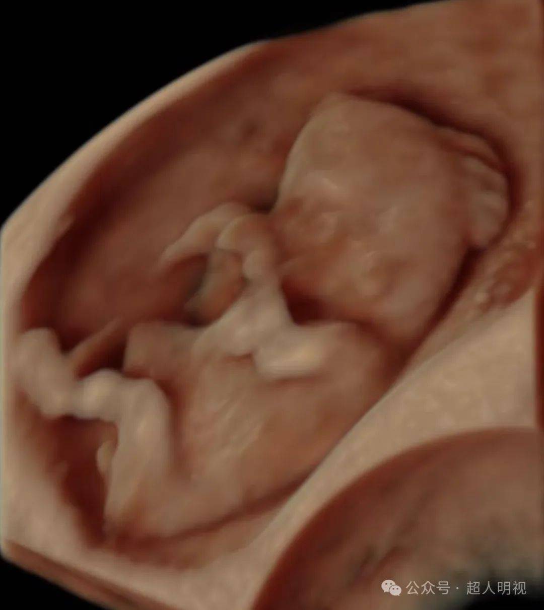 看几张日常图和超声图,想几件人生和诊断事