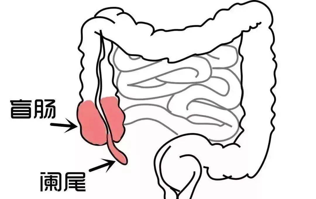 回肠末端位置图片