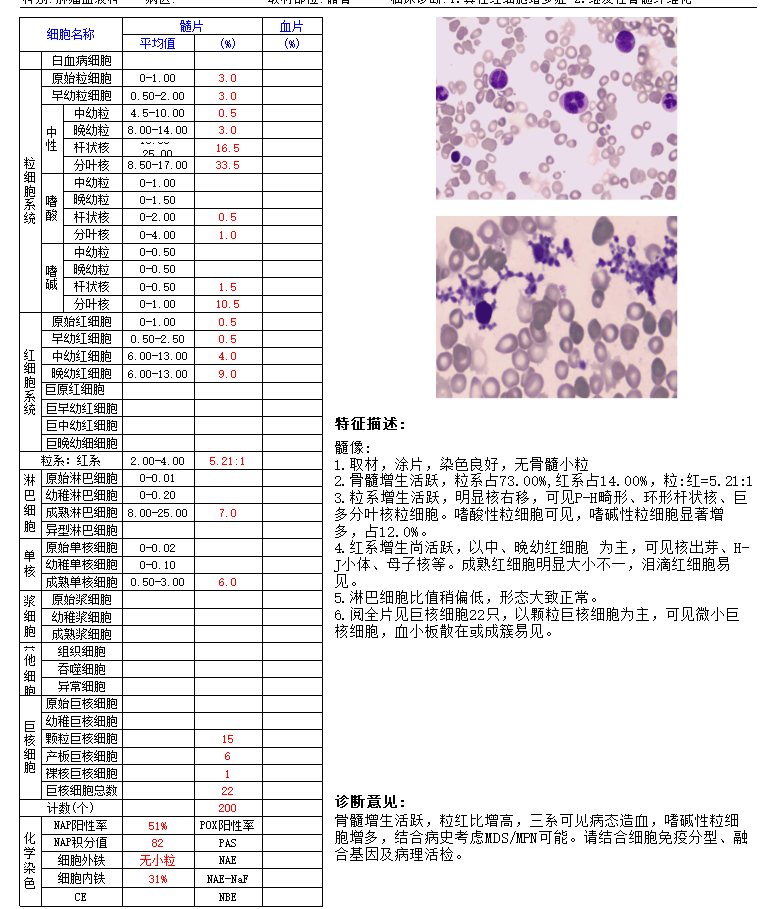 骨髓涂片报告图片