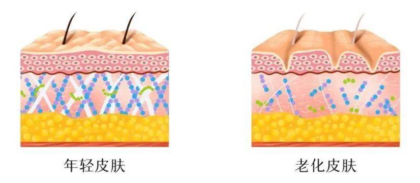 衰老最大元凶“光老化”，应该怎么预防和改善？_皮肤_紫外线_细胞